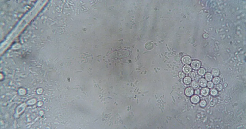 découvrez tout sur les bactéries rares, leurs caractéristiques uniques, leur importance scientifique et leur impact sur la santé et l'environnement.
