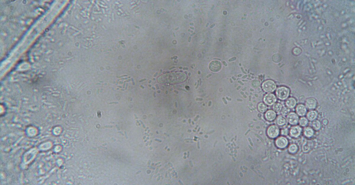 découvrez tout sur les bactéries rares, leurs caractéristiques uniques, leur importance scientifique et leur impact sur la santé et l'environnement.